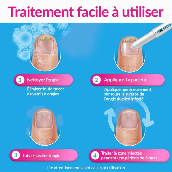 Excilor Easy Stylo de Traitement de la Mycose de l'Ongle - Simple & Rapide - stylet de 4ml