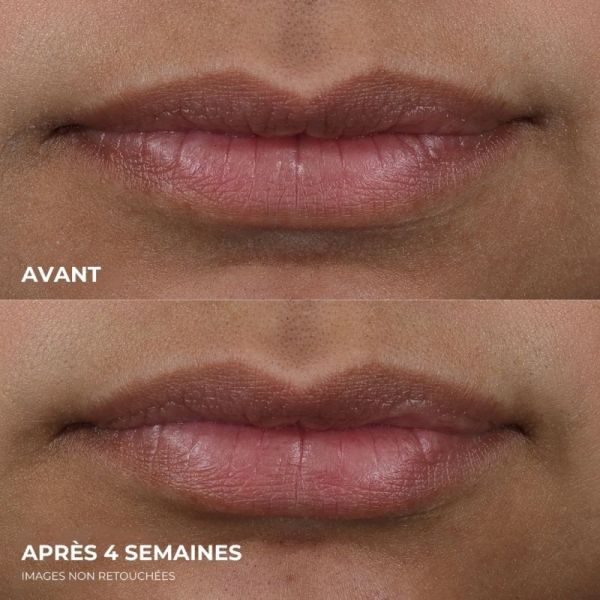 RoC Derm Correxion Lip Volumiser 10ml - Soin volumateur de lèvres sans injection