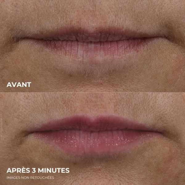 RoC Derm Correxion Lip Volumiser 10ml - Soin volumateur de lèvres sans injection