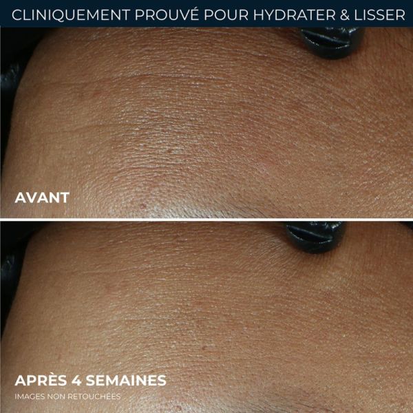 RoC Multi Correxion Soin Lissant Crème Hydratation Maximale 50ml – Rides et hydratation