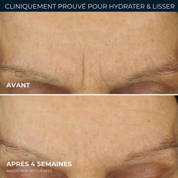 RoC Multi Correxion Soin Lissant Crème Hydratation Maximale 50ml – Rides et hydratation