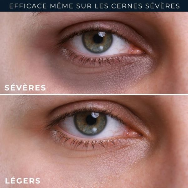 RoC Derm Correxion Eye Repair 15 ml - Soins Ciblés Pour Cernes