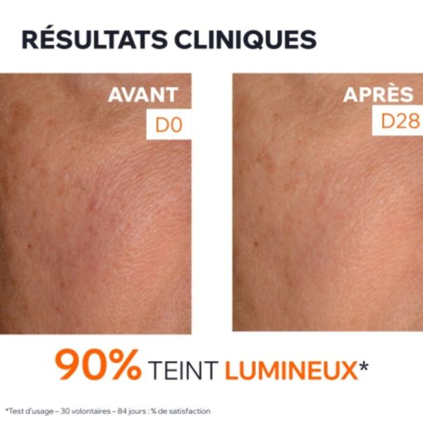 Uriage Depiderm Soin Intensif Anti-Taches 30 ml - Corrige les tâches et unifie le teint