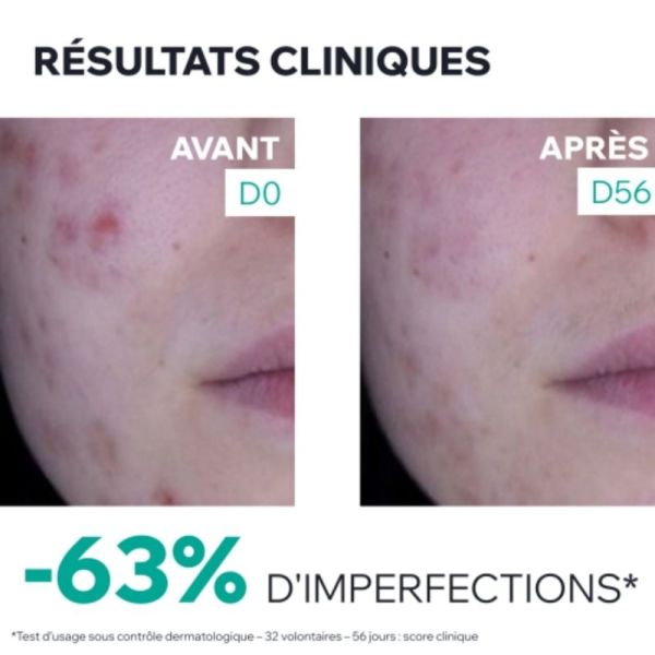 Uriage Hyséac 3-Regul+ Soin Global Anti-Imperfections 40 ml - Rééquilibre le microbiome et corrige toutes les imperfections