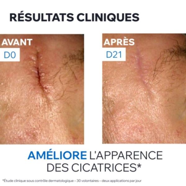 Uriage Bariéderm-Cica Crème au Cuivre Zinc 40 ml - Restaure et hydrate les peaux irritées