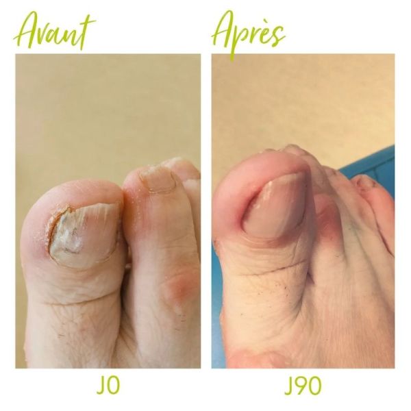 Alvadiem Soin Assainissant Ongles à la Propolis Noire - 10ml
