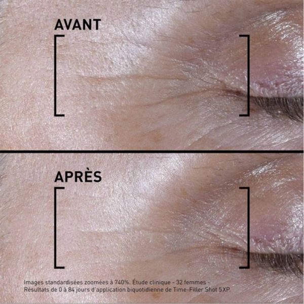 Filorga TIME-FILLER SHOT 5 XP Sérum Concentré Rides d'Expression 15 ml – Soin décrispant ciblé effet botox-like