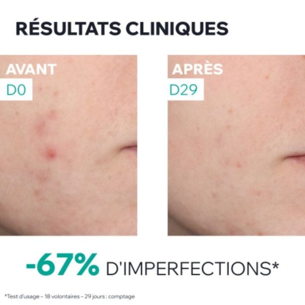 Uriage Hyséac Sérum Peau Neuve Booster Anti-Imperfections 30 ml - Lisse, affine et resserre les pores
