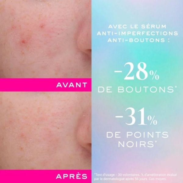 Nuxe Zinc Power Duo Anti-Imperfections - sérum et fluide matifiant offert
