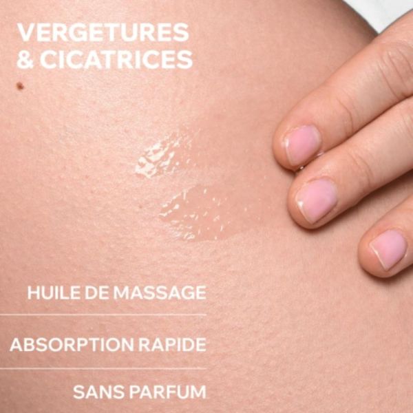 Uriage Bariéderm-Cica Huile Dermatologique 100 ml - Prévient et corrige les vergetures
