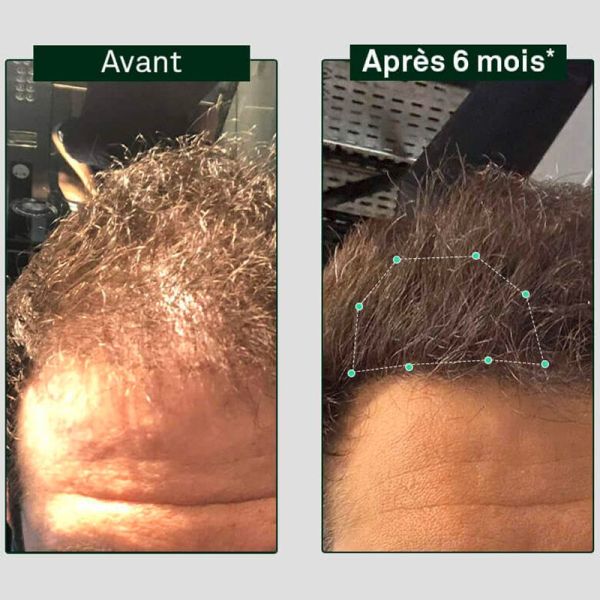 Luxéol Shampooing Pousse - 200ml -  Favorise la densité capillaire