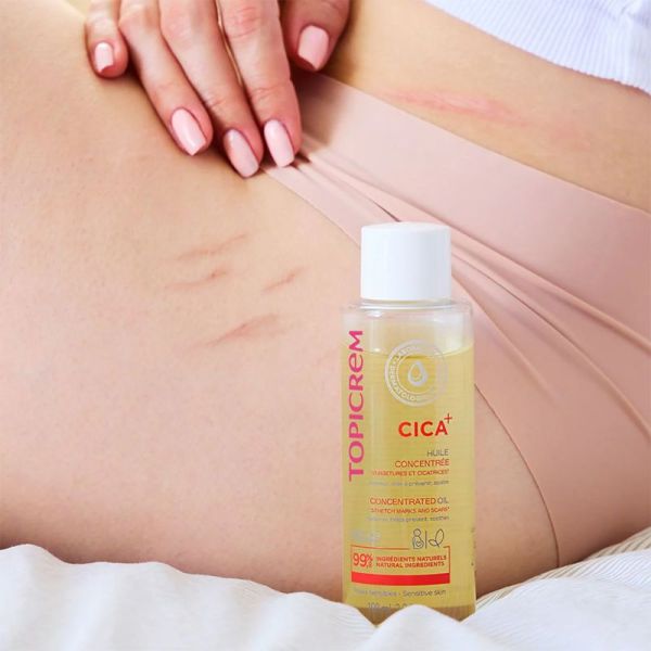 Topicrem CICA+ Huile Concentrée Vergetures et Cicatrices 100ml – Atténuation et confort cutané