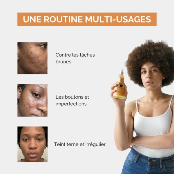 Curculia Crème Hydratante Au Curcuma 50ml – Éclat et anti-imperfections
