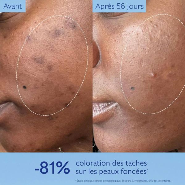 Caudalie Vinoperfect Sérum Éclat Anti-Taches à la Viniférine 30ml – Éclat et anti-taches