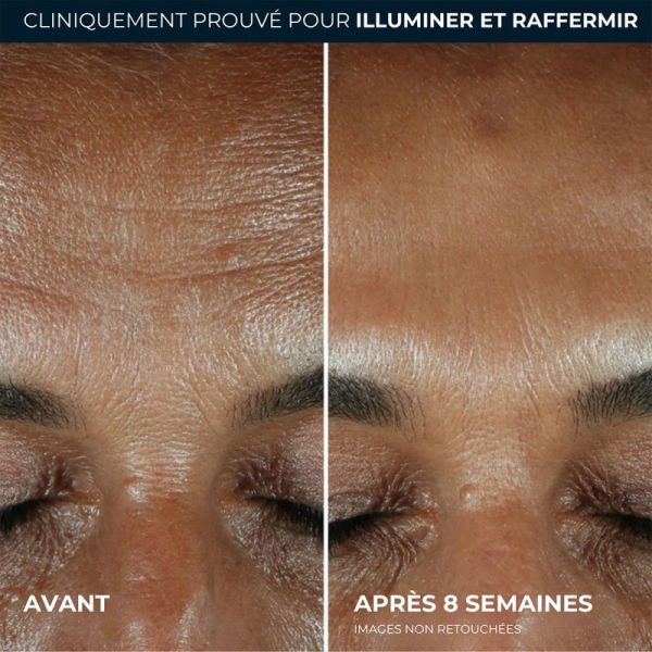 RoC Multi Correxion Renouveau + Éclat Sérum Quotidien 30 ml – Anti-âge et booster de teint