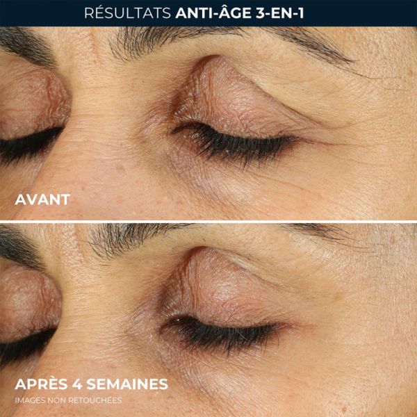 RoC Retinol Correxion Soin Lissant Crème Yeux 15ml – Rides, poches et cernes