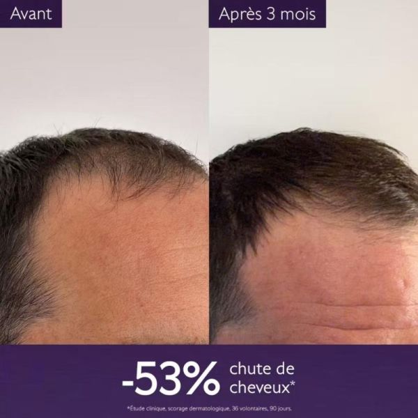 Caudalie Sérum Capillaire Anti-chute 50ml - Réduit la chute de cheveux et renforce la densité