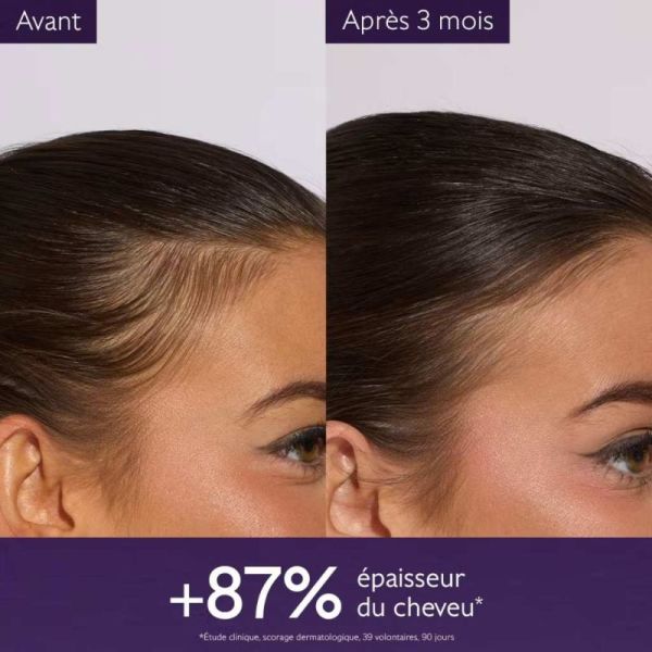 Caudalie Sérum Capillaire Anti-chute 50ml - Réduit la chute de cheveux et renforce la densité