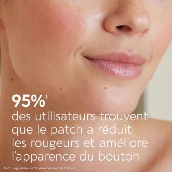 Biocyte Active Pimple Patchs X9 - Correcteur ciblé anti-imperfections et boutons aux actifs purifiants