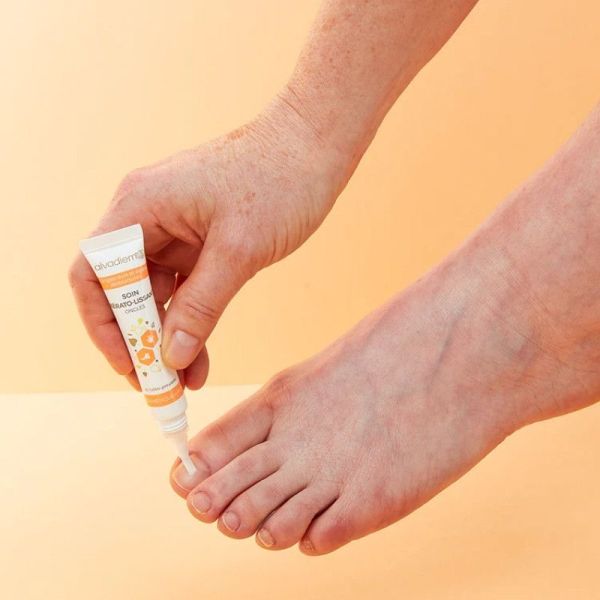 Alvadiem Soin Kérato-Lissant Ongles à la Propolis Noire - 10ml