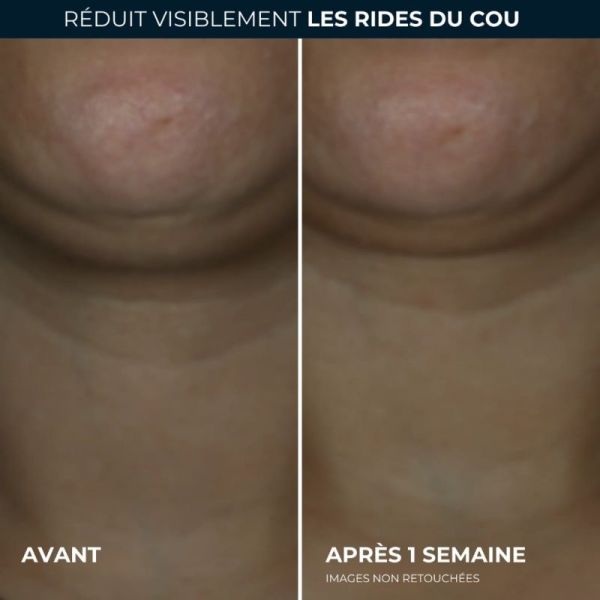 RoC Derm Correxion Crème Contour 50 ml - Resculpte et réduit les rides du cou