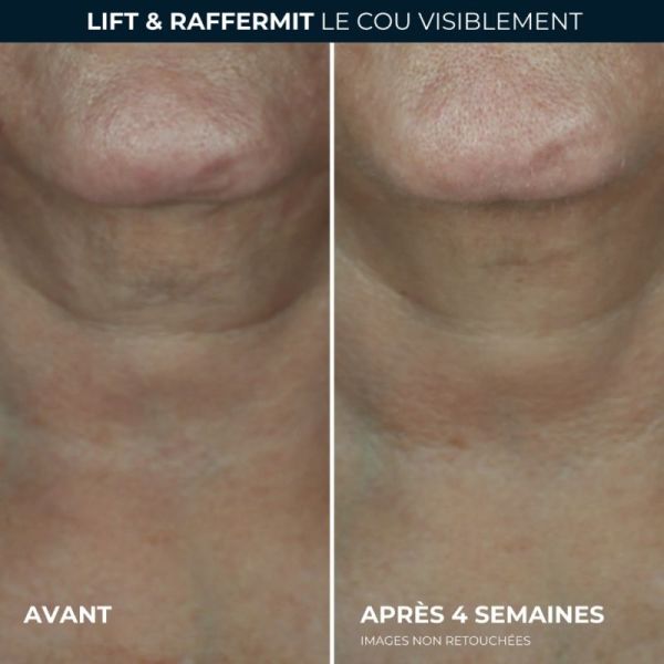 RoC Derm Correxion Crème Contour 50 ml - Resculpte et réduit les rides du cou