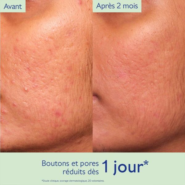 Caudalie Vinopure Sérum à l'Acide Salicylique Anti-imperfections 30ml – Pureté et fraîcheur