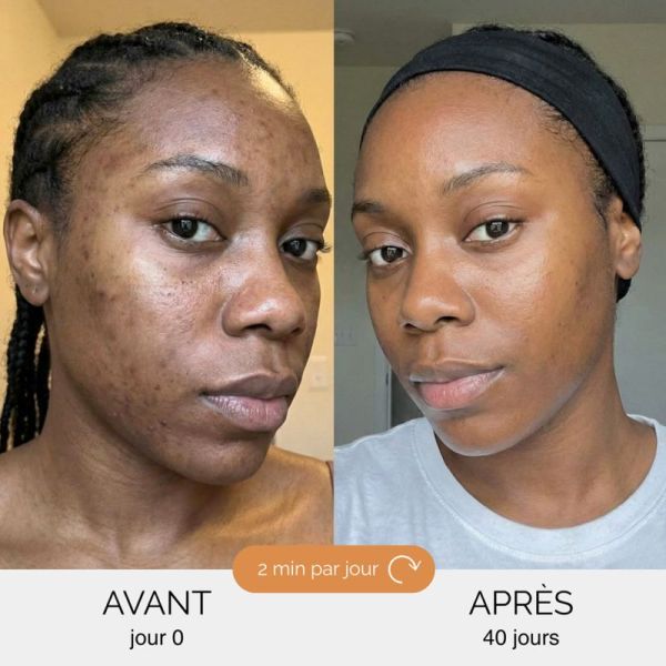 Curculia Sérum Anti-Imperfections 3 En 1 30ml – Éclat et correction