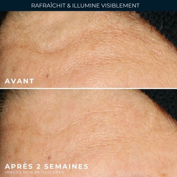 RoC Multi-Correxion Renouveau + Éclat 177 ml - Gel Nettoyant Profond qui Réveille l'Eclat