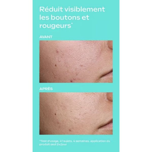 Weleda Clear & Pure Skin Serum Drops 30 ml - Peau nette et purifiée en 7 jours