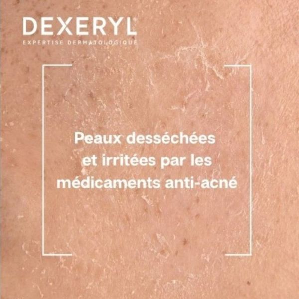 Dexeryl Dexeclear Crème Hydratante Réparatrice 40 ml - Hydrate et apaise les peaux sous traitement anti-acné