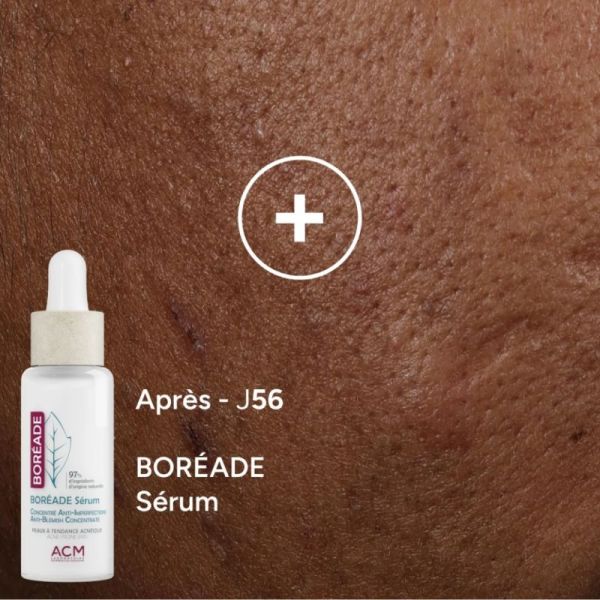 ACM Boréade Sérum 30 ml - Corrige les imperfections et matifie la peau