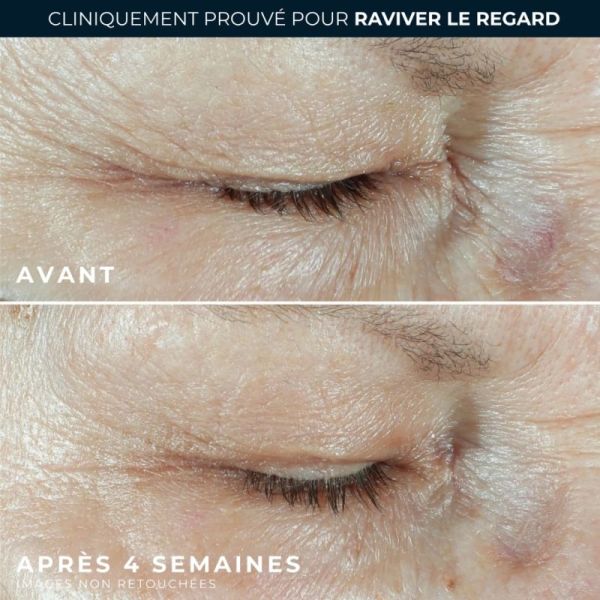 RoC Multi Correxion Hydrater + Repulper 15 ml - Contour des Yeux Hydratant