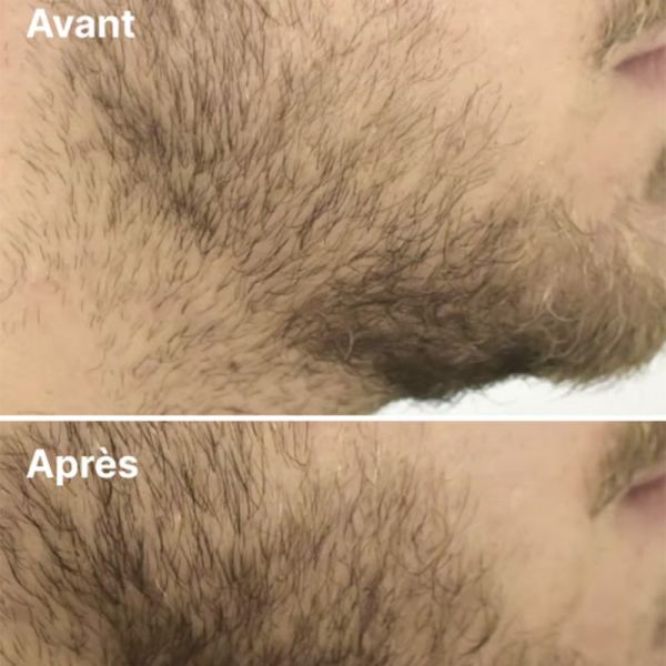 Horace Sérum Barbe Extrait Herbe Sacrée + Pichia Minuta - 50ml - Stimule la pousse et densifie la barbe