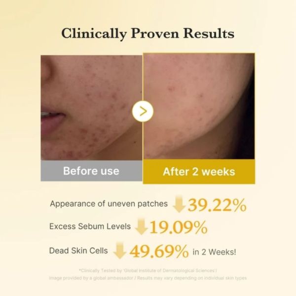 Medicube Kojic Turmeric Pad 70 cotons - Disques exfoliants et éclat du teint