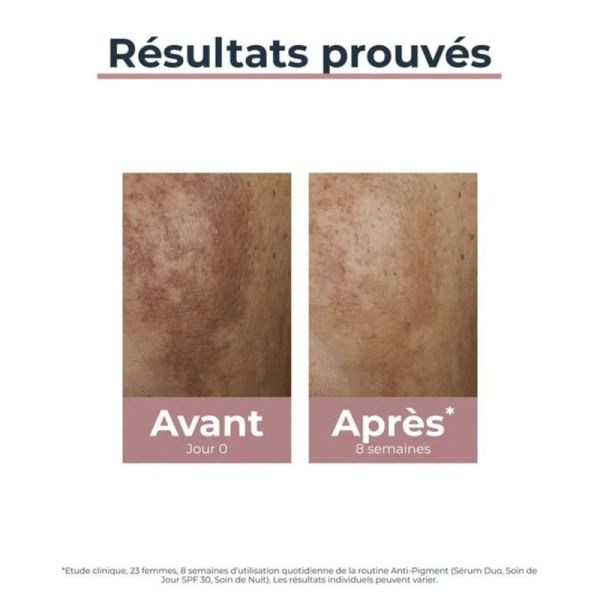 Eucerin Anti-Pigment Sérum Duo 30ml – Anti-taches et fermeté