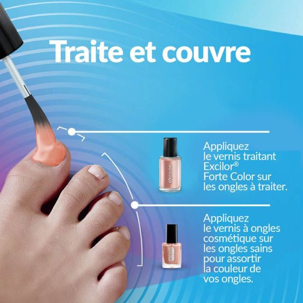 Excilor Forte Color Vernis Traitement - 30ml - Couleur : Nude - Soin traitant & esthétique 2 en 1