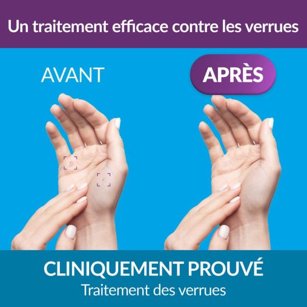 Excilor Traitement Verrues CRYO - Élimination efficace par cryothérapie