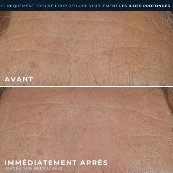 RoC Retinol Correxion Crème Riche Pour Rides Profondes 30 ml - 100 heures d'hydratation