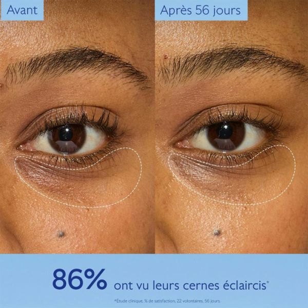 Caudalie Vinoperfect Soin Éclaircissant Regard Anti-Cernes 15ml – Éclat et anti-taches