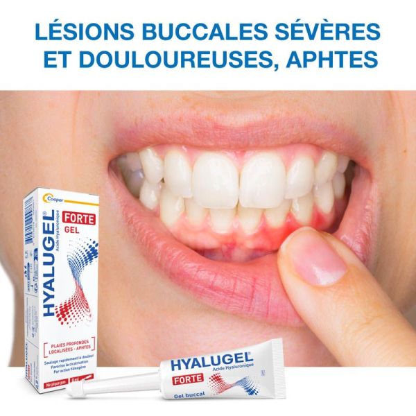 Hyalugel Forte Gel Buccal - 8ml - Plaies profondes, aphtes et lésions localisées