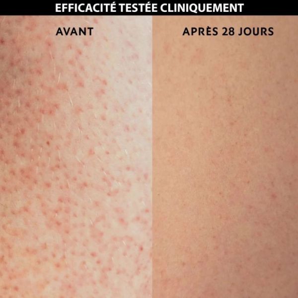 Alvadiem Keratolia+ Fluide Corps Anti-Rugosités 75 ml - Lisse et apaise la peau