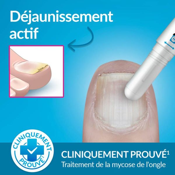 Excilor Easy Stylo de Traitement de la Mycose de l'Ongle - Simple & Rapide - stylet de 4ml