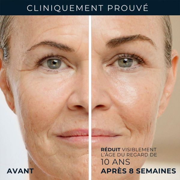 RoC Retinol Correxion Soin Lissant Crème Yeux 15ml – Rides, poches et cernes
