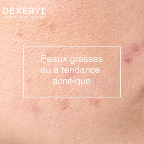 Dexeryl Dexeclear Gel Moussant Anti-Imperfections 400ml – Nettoyant purifiant peaux grasses