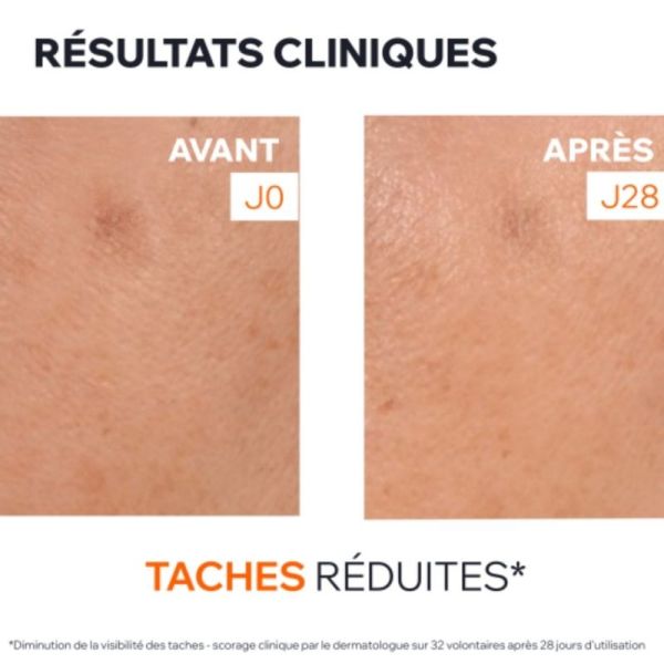 Uriage Depiderm Sérum Anti-Taches Booster Éclat 30 ml - Unifie, lisse et illumine la peau