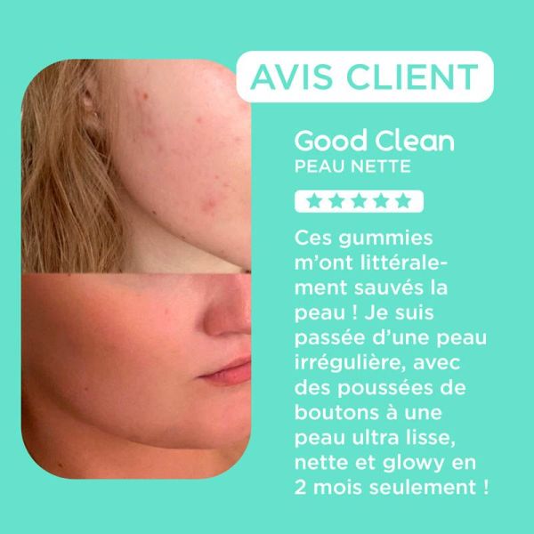 Lashilé Beauty Good Clean Perfect Boost Peau Nette - Réduit les Imperfections de la Peau -  60 Gummies