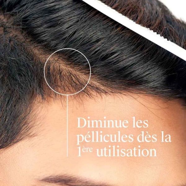Neutrogena T/Gel Fort Shampoing Démangeaisons Sévères 250 ml - Apaise les démangeaisons intenses