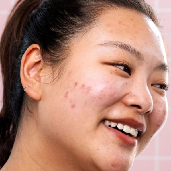 SVR Sebiaclear Pure - 30 Gélules - Complément Alimentaire Anti-Imperfections