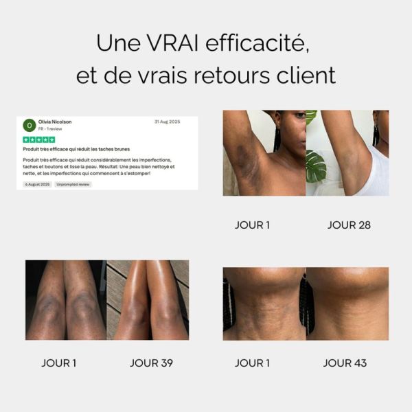 Curculia Savon Au Curcuma 100g – Éclat et anti-imperfections corps
